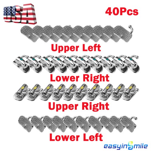 40pc dental buccal molar tubes - 40pc,